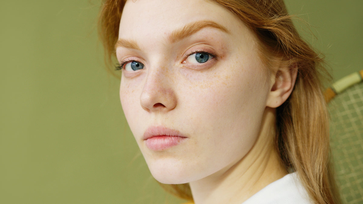Can Eye Cream Cause Milia? How to Care for Tiny Bumps Under Your Eyes